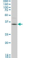 Monoclonal Mouse anti-Human PBK / TOPK Antibody (clone 3A7, IHC, IF, WB)