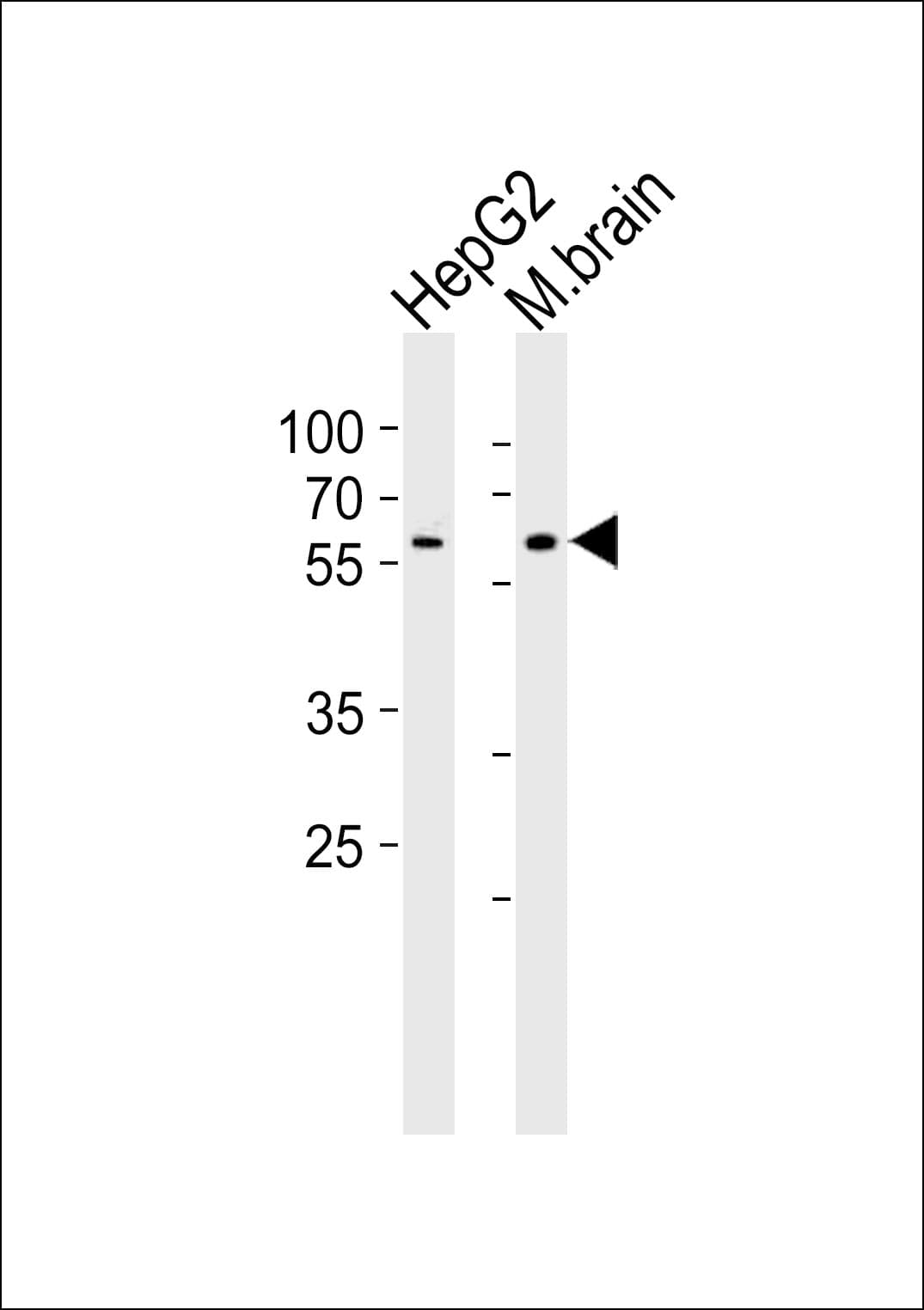 PAPD4 Antibody (aa58-87)