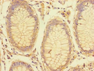 LRRC61 Antibody