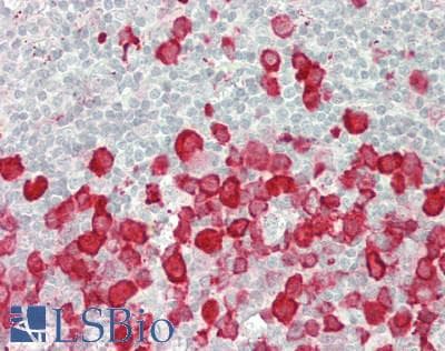 IHC-plus™ RRM2 Antibody