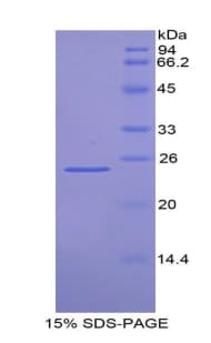 Mouse FDFT1 / Squalene Synthase Protein (Recombinant His)