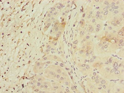 PPM1D / WIP1 Antibody