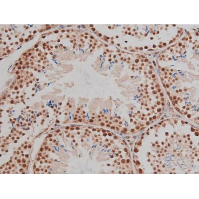 IGF1R / IGF1 Receptor Antibody (phospho-Tyr1346)