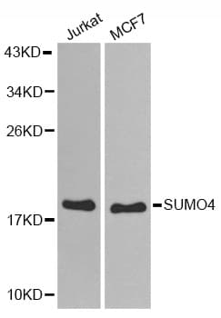 Polyclonal Rabbit anti-Human SUMO4 Antibody (IHC, WB)