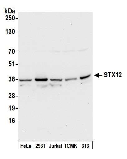 Polyclonal Rabbit anti-Human STX12 / Syntaxin 12 Antibody (aa1-50, WB)