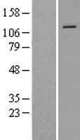 SMARCA5 / SNF2H Protein (Over-Expression Lysate Myc-DDK (Flag))