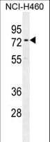 CCDC63 Antibody (aa532-560)