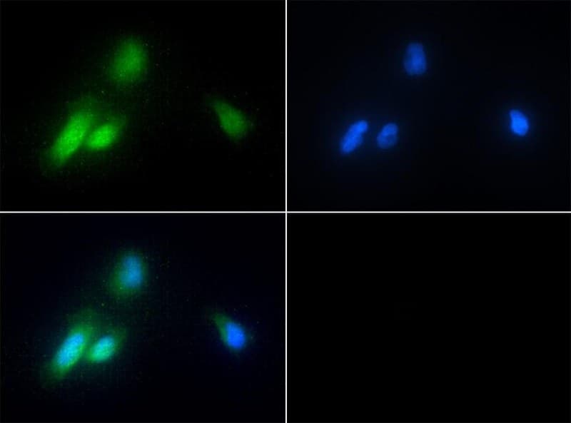 CHORDC1 / CHP1 Antibody