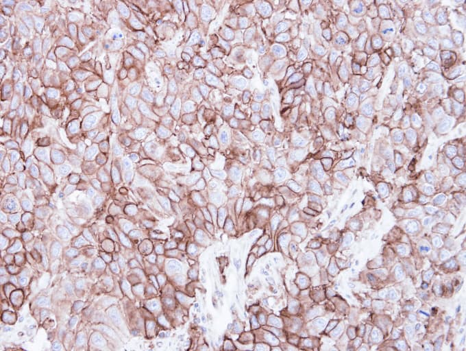 CAV2 / Caveolin 2 Antibody (aa1-45)
