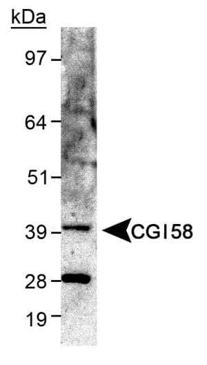 ABHD5 Antibody (aa200-300)