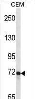 PTPRE / PTP Epsilon Antibody (aa134-163)