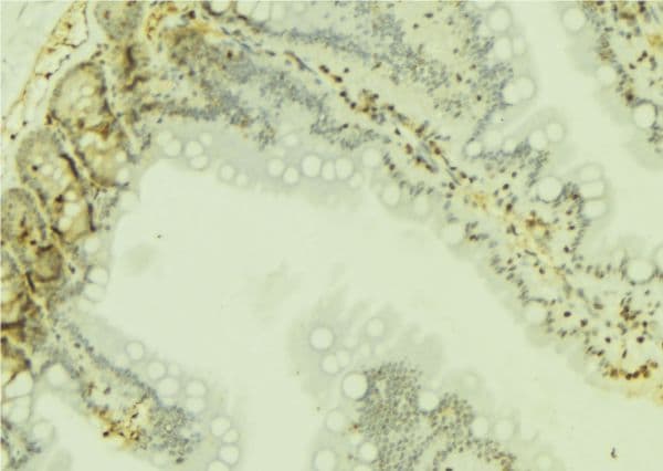 RPS19 / Ribosomal Protein S19 Antibody