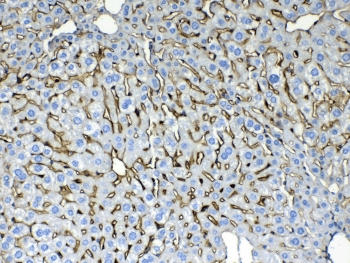 KRT8 / CK8 / Cytokeratin 8 Antibody
