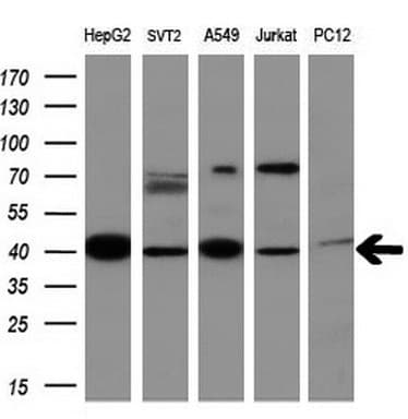 MMP13 Antibody (aa104-471, clone OTI2D8)