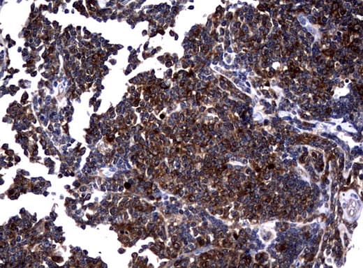 Monoclonal Mouse anti-Human NME1 / NM23 Antibody (clone UMAB93, IHC, IF, WB)
