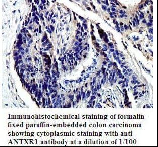 ANTXR1 / TEM8 Antibody (aa19-196)