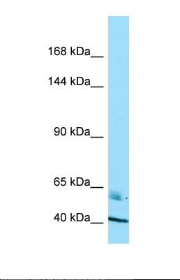 Polyclonal Rabbit anti-Human Radil Antibody (C-Terminus, WB)