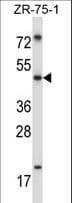 Polyclonal Rabbit anti-Human MDM4 / MDMX Antibody (aa128-157, WB)