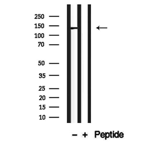 CADPS2 Antibody
