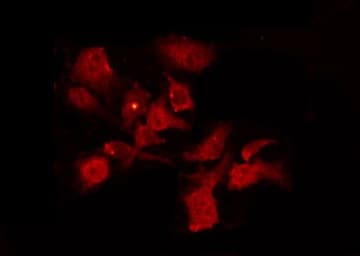 Polyclonal Rabbit anti-Human CHEK1 / CHK1 Antibody (phospho-Ser296, IHC, IF, WB)