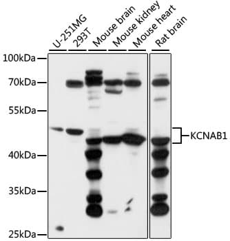 KCNAB1 Antibody