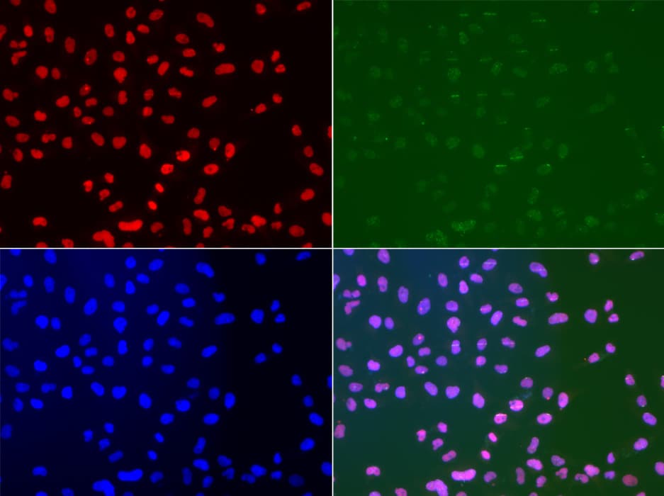 Polyclonal Rabbit anti-Human MSH2 Antibody (IHC, IF, WB)