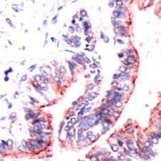Polyclonal Rabbit anti-Human OCLN / Occludin Antibody (C-Terminus, IHC, WB)