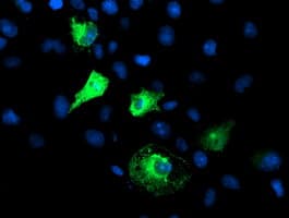 FBXO21 Antibody (clone OTI2C7)