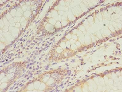 Polyclonal Rabbit anti-Human CCT6B Antibody (IHC)