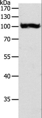 GPBB / PYGB Antibody