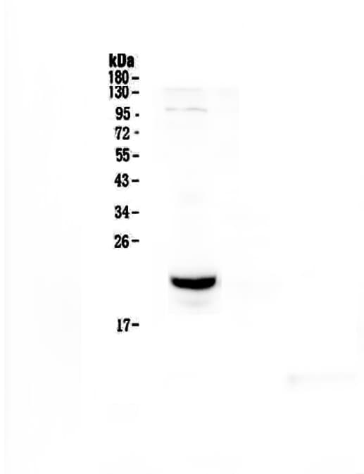 Polyclonal Rabbit anti-Mouse CD81 Antibody (WB)
