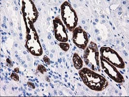 ATP6V1B1 Antibody (clone OTI3B11)