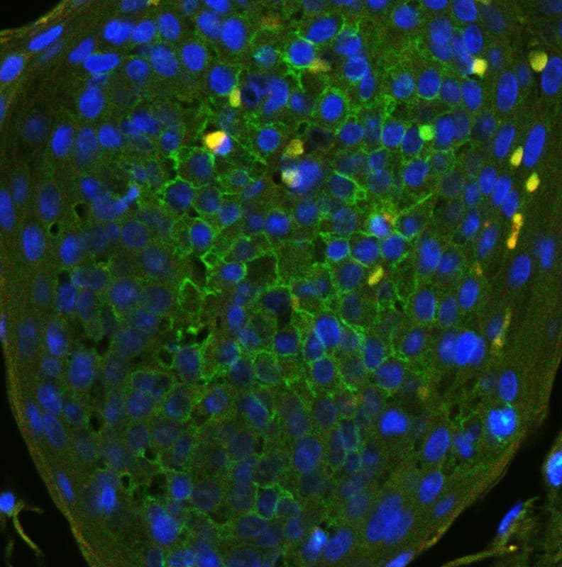 Polyclonal Rabbit anti-Human CD44 Antibody (aa29-56, IHC, WB)