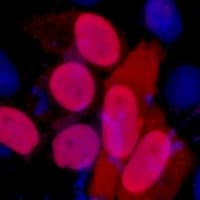 DYKDDDDK Tag Antibody