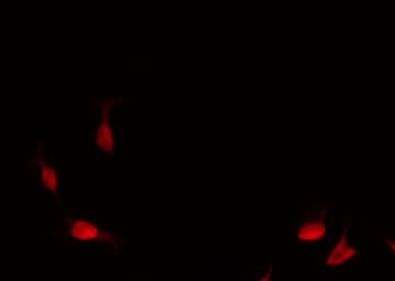 Polyclonal Rabbit anti-Human ATXN1 / SCA1 Antibody (phospho-Ser775, IF, WB)