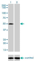 IHC-plus™ ACP2 / Acid Phosphatase 2 Antibody (clone M1-4A12)