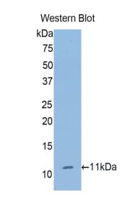 COL2A1 / Collagen II Alpha 1 Antibody (aa1386-1467)