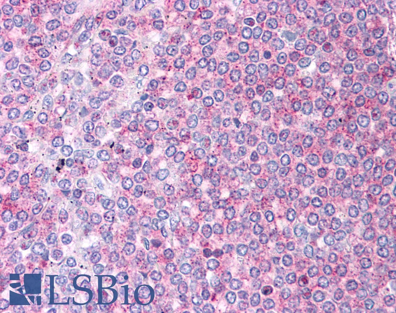 Polyclonal Rabbit anti-Human DBT / E2 Antibody (aa35-84, IHC, WB)