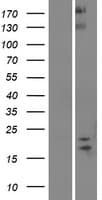 SPAG11B Protein (Over-Expression Lysate Myc-DDK (Flag))