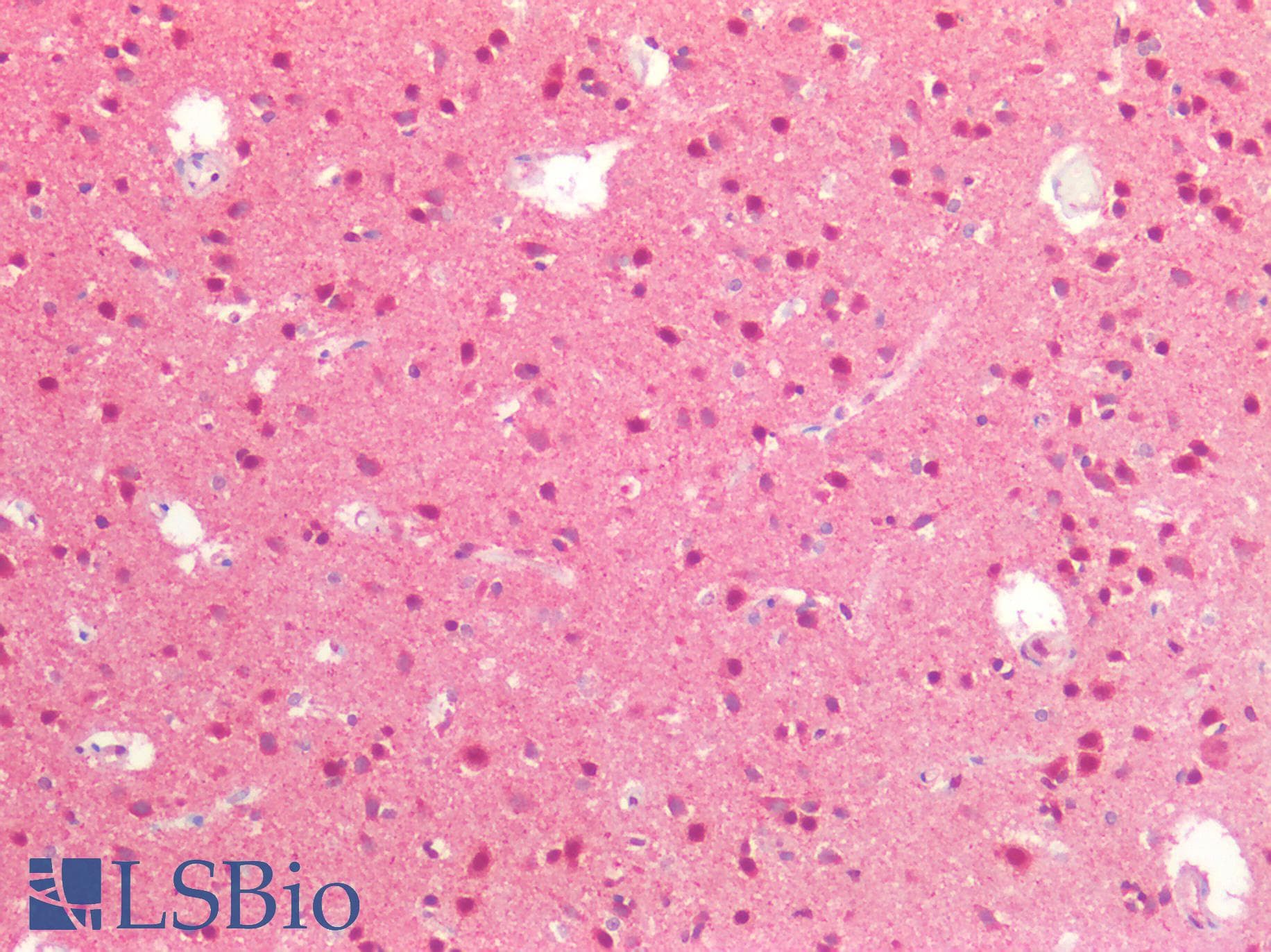 LMX1B Antibody