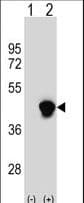 Polyclonal Rabbit anti-Human ECI2 / PECI Antibody (aa331-358, IHC, WB)
