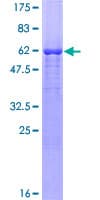 Human MOAP1 / MAP1 Protein (Recombinant GST)