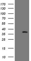 SNAI2 / SLUG Antibody (clone OTI2C3)