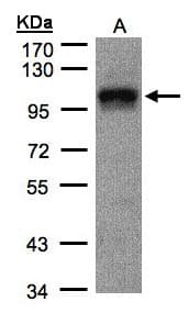 IHC-plus™ DAP-5 / EIF4G2 Antibody