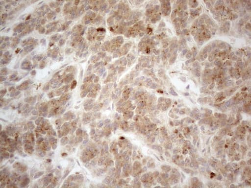 VIP Antibody (clone OTI1C3, Carrier-free)