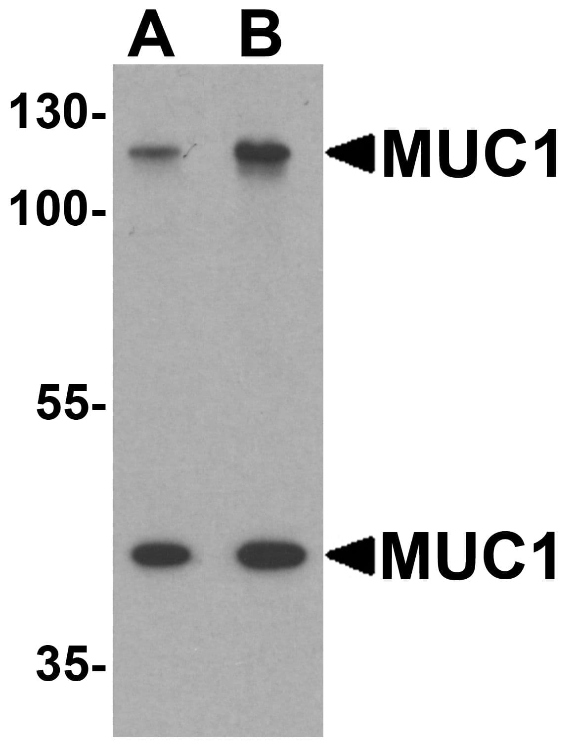 IHC-plus™ EMA / MUC1 Antibody