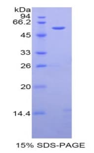Rat AGT / Angiotensinogen Protein (Recombinant His-S)