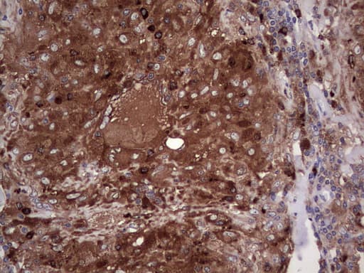 Monoclonal Mouse anti-Human PKM2 Antibody (clone 11B11, IHC, WB)