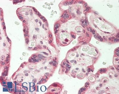 ADAM15 Antibody (HRP)