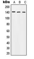 APP / Beta Amyloid Precursor Antibody (phospho-Thr743)